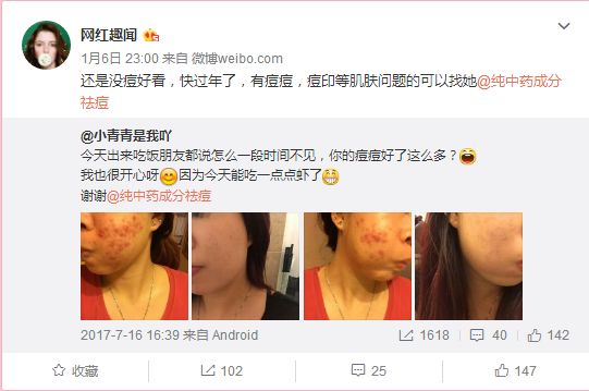 在微博平台上评论刷赞的设置选项位于哪里