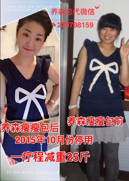 瘦瘦包减肥代理真的有效吗？它的减肥原理究竟是怎样的？